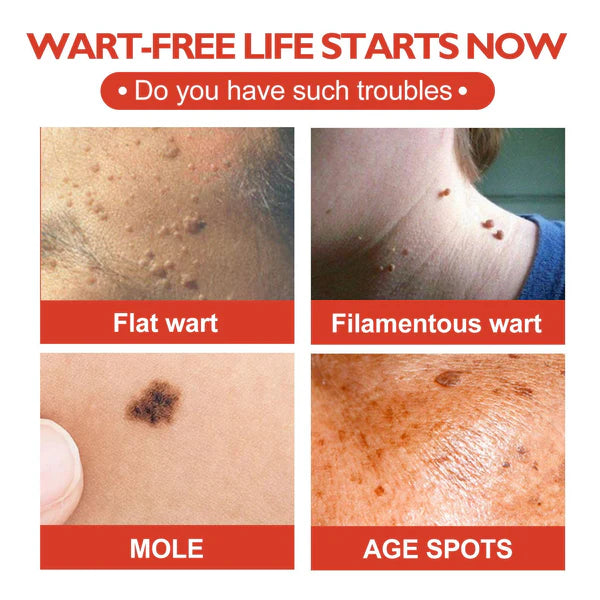 Clear Skin Acne, Skin Tag & Wart Patches